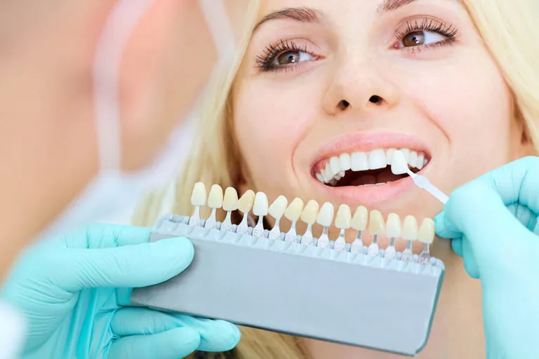 An unseen dentist holds a teeth whitening chart up to the mouth of a female dental patient to compare tooth shades