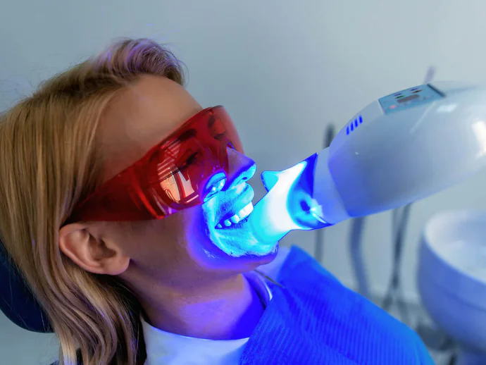 Teeth Whitening in Denver, NC at Summit Family Dentistry